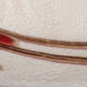Ejemplares macho y hembra del piojo de mar. Foto: Sea Lice Research Centre